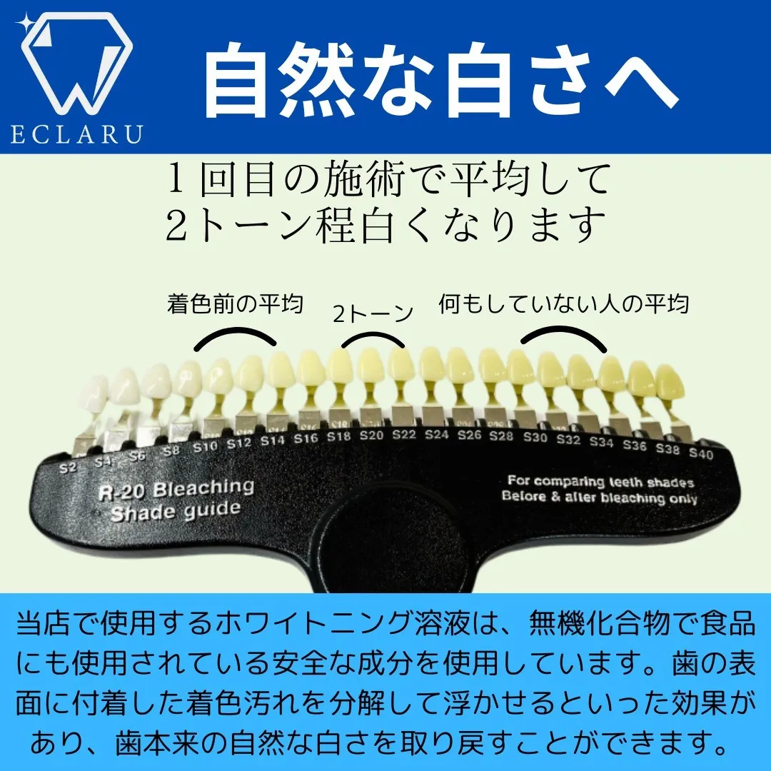 ✨透明感あふれる白い歯の秘訣、実はもう見つかってるんです💡