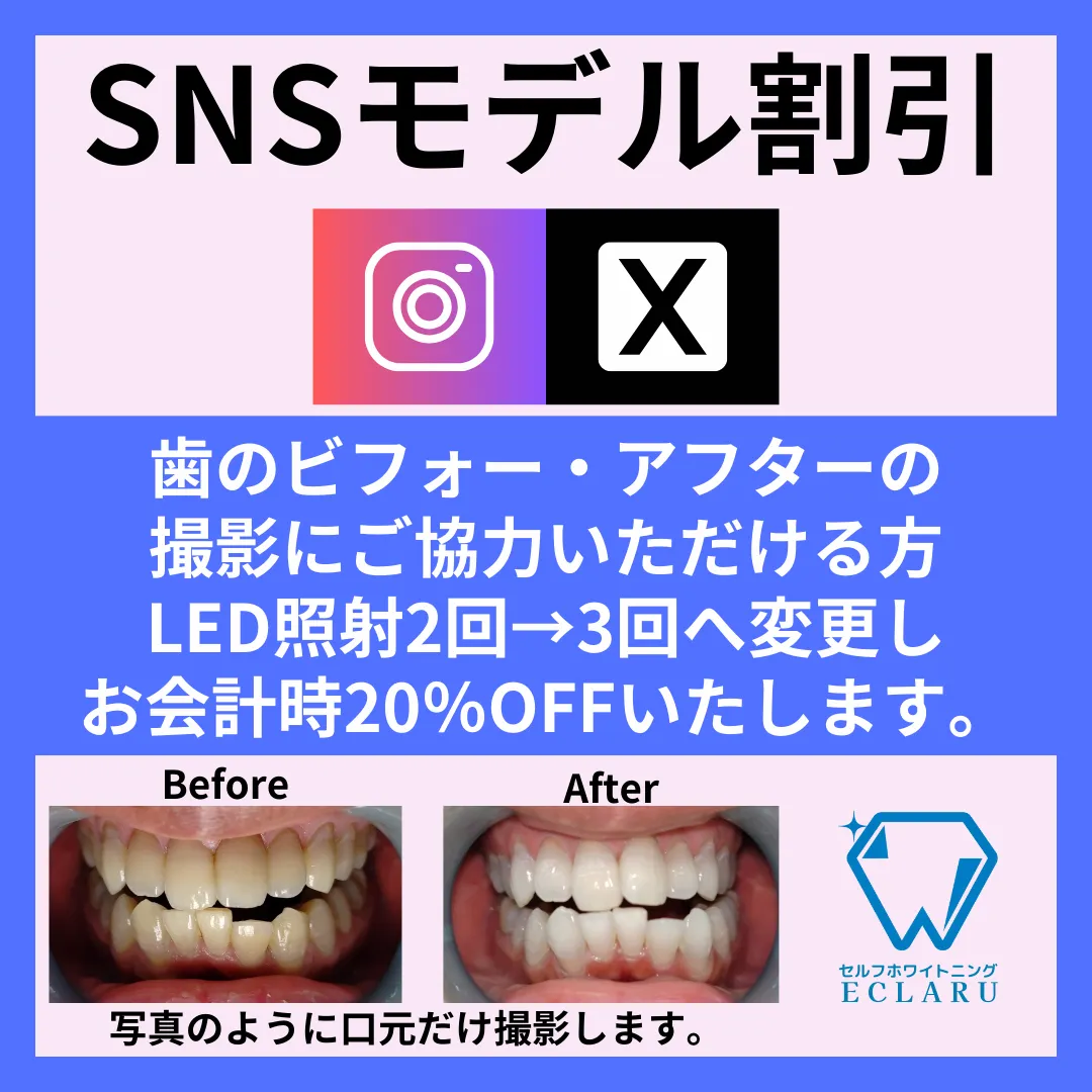 SNSモデル割引始めました📢