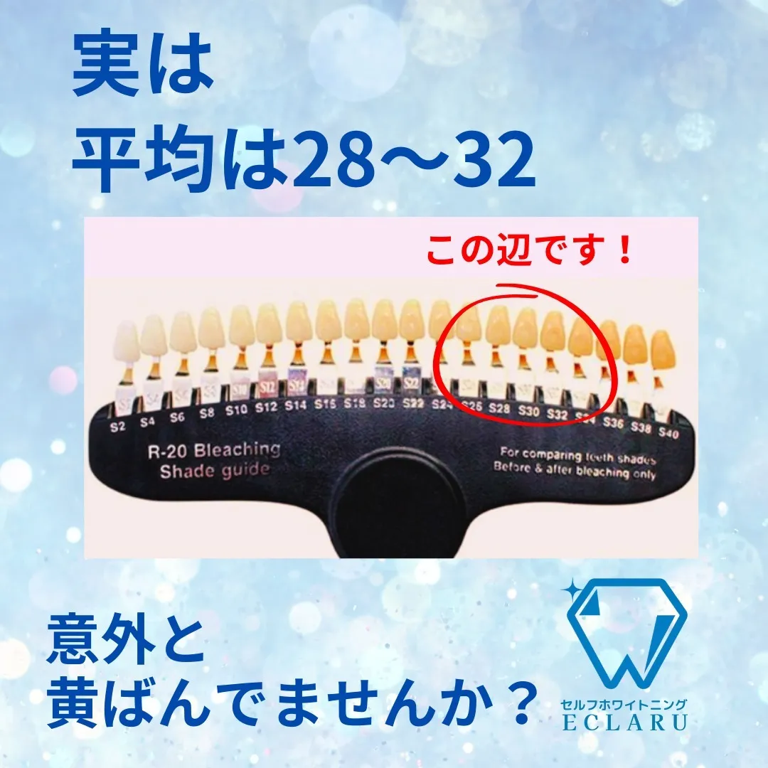 日本人の平均的な歯の色は知っていますか？