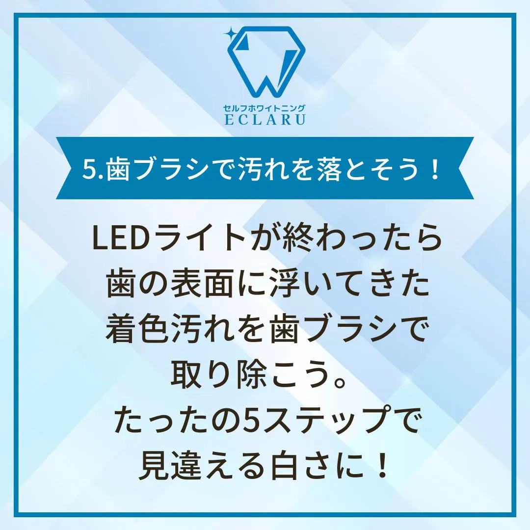 サロンでのホワイトニング手順を5ステップで紹介✨